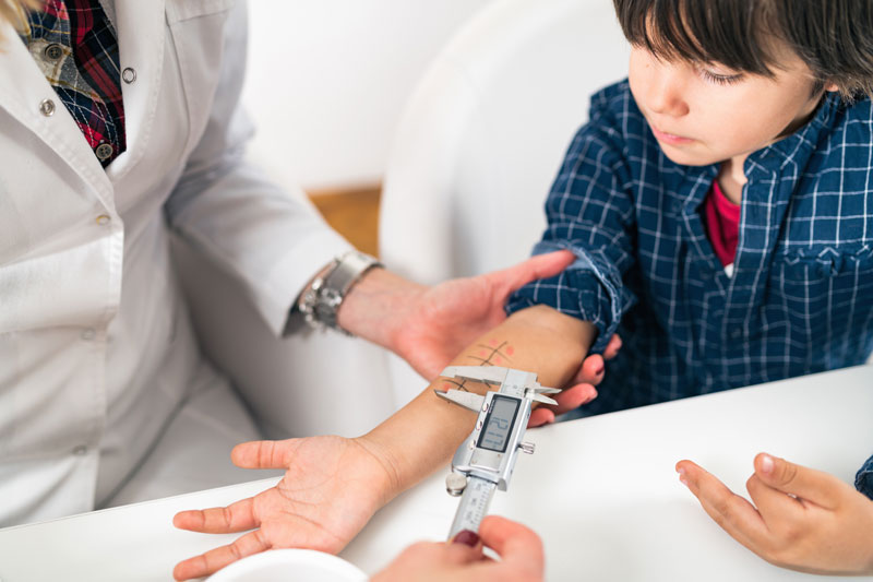 Doctor performing an allergy test and measuring results on forearm of young boy