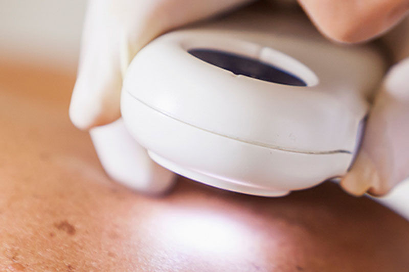 Physician inspecting skin up close