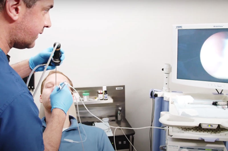 Physician performs the non-invasive balloon sinuplasty procedure in a medical office with a male patient.