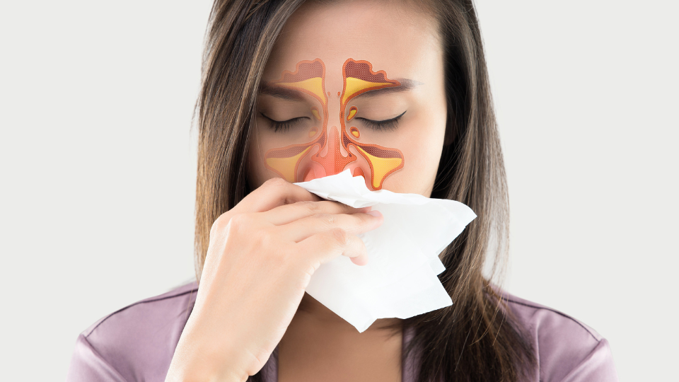 10 Signs You Have a Sinus Infection